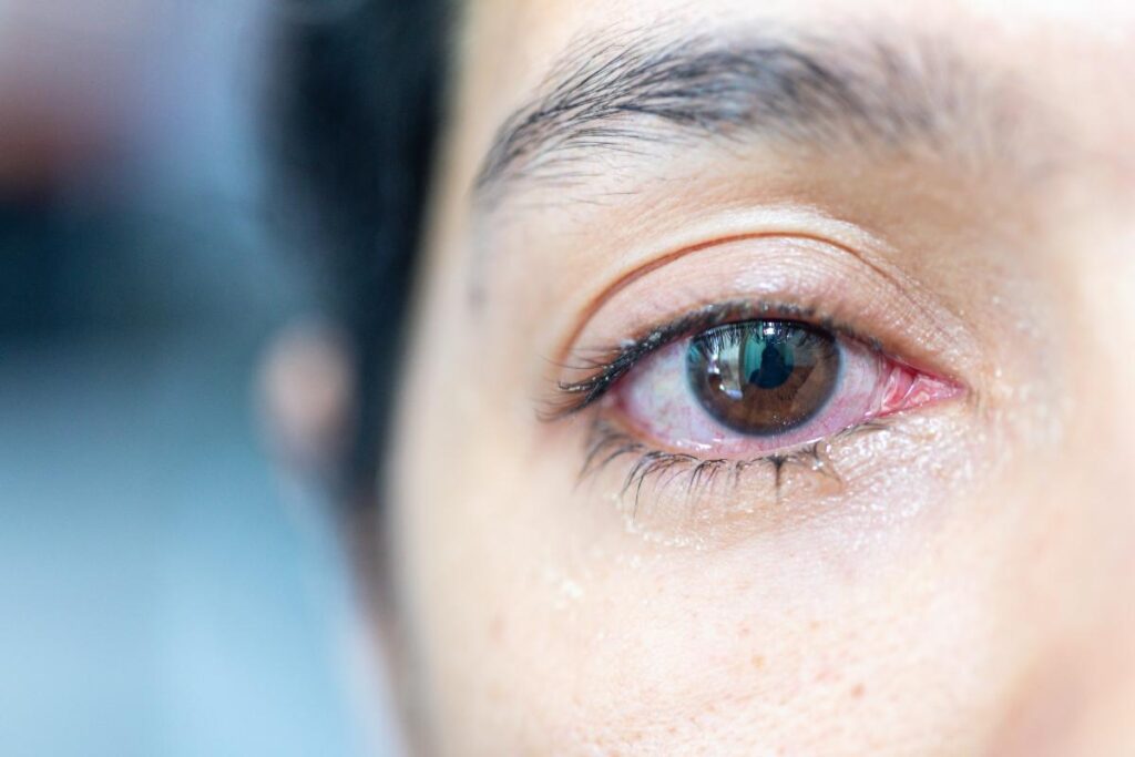 signs of a heroin overdose